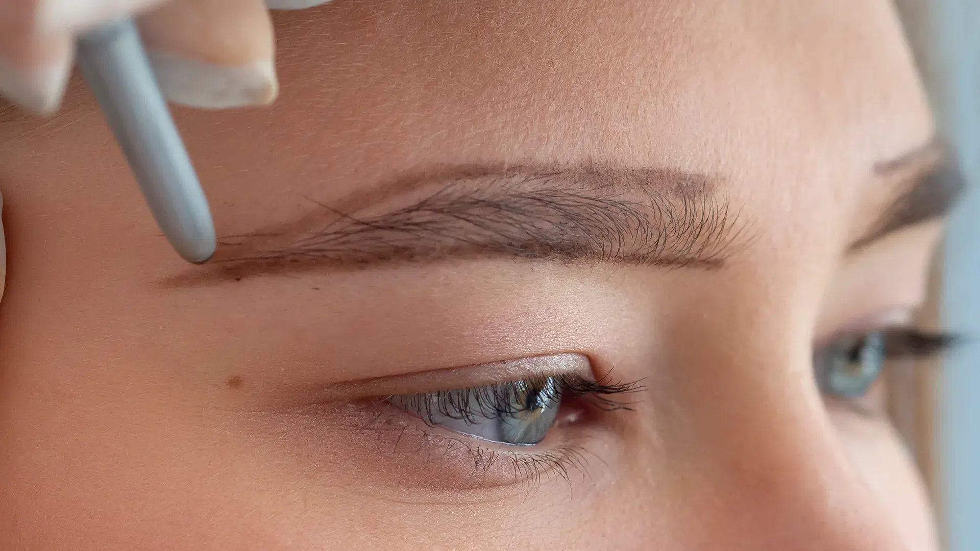 Benefits of a DHI Eyebrow Transplant