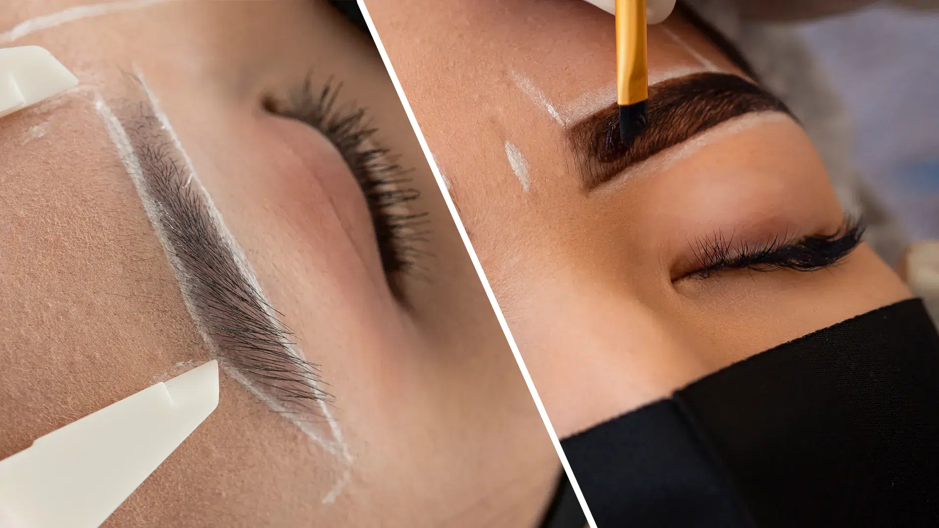 Eyebrow Transplant vs Microblading