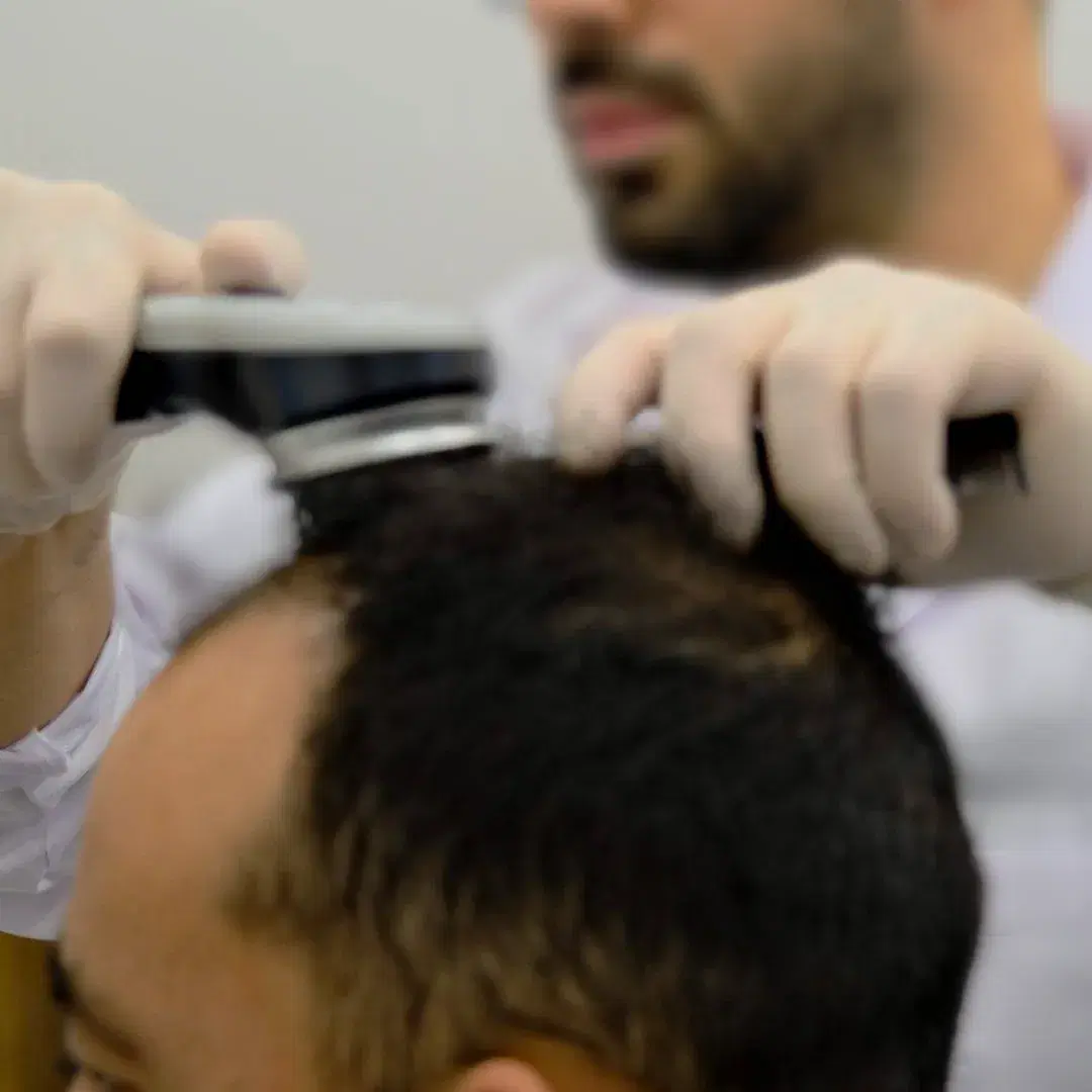 Ozone Therapy for Hair: Boost Growth and Scalp Health