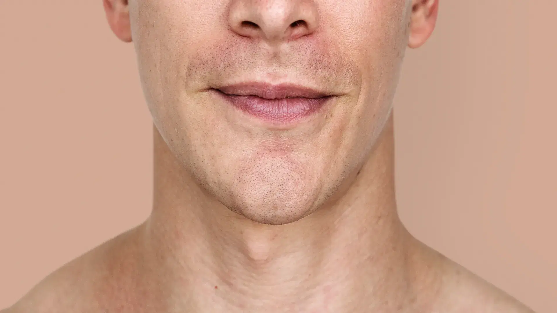 Who Can Get a Facial Hair Transplant