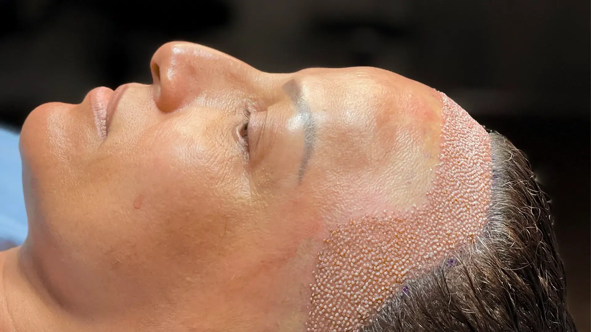 Die DHI-Technik für Frauen