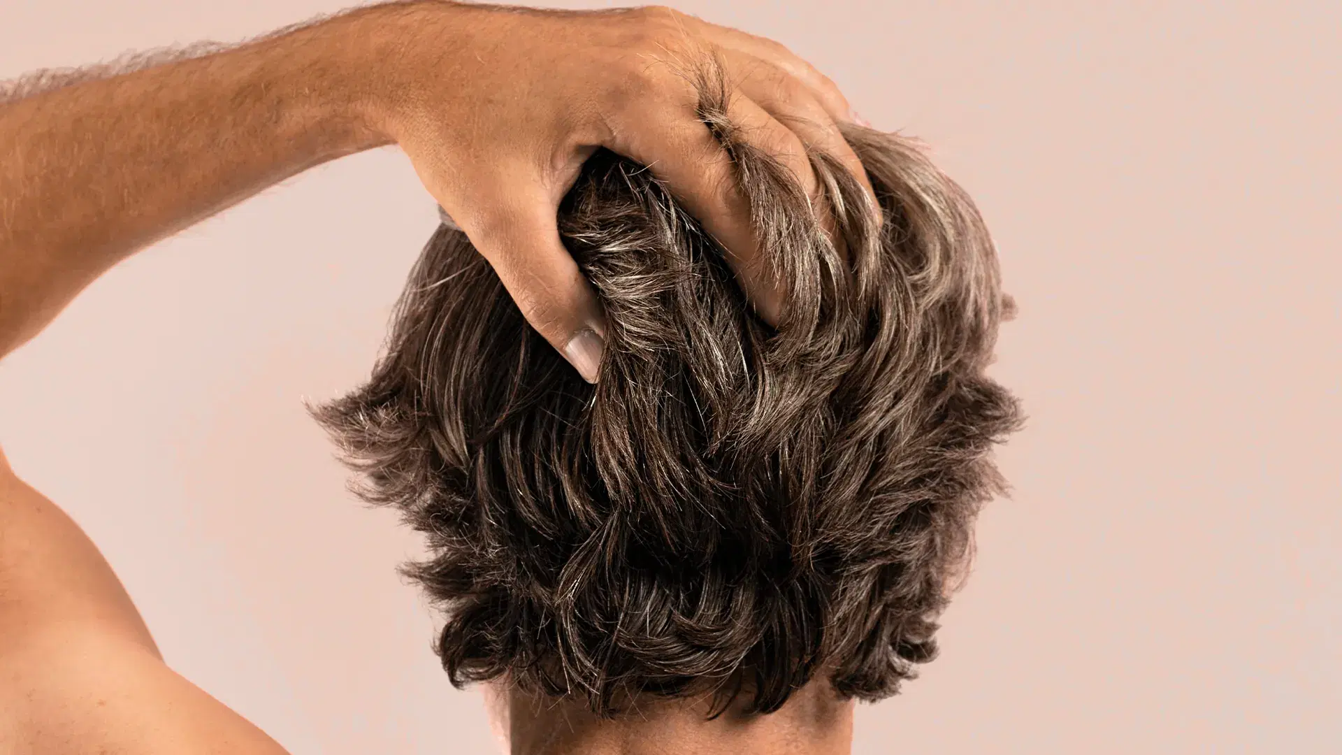 Benefits of PRP for Hair