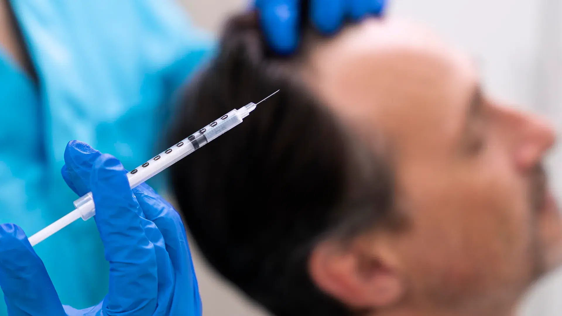 Was ist Mesotherapie für Haare?